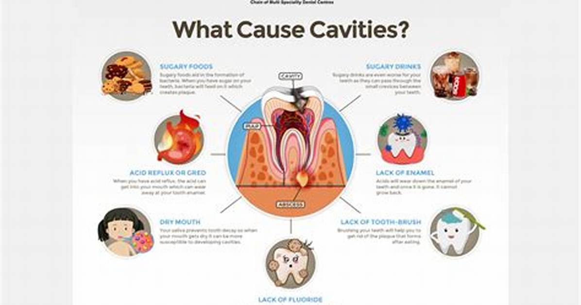 Does Capping Teeth Prevent Cavities?