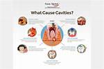 Does Capping Teeth Prevent Cavities?