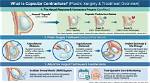 Does Capsular Contracture Hurt?