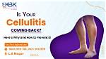 Does Cellulitis Keep Coming Back?