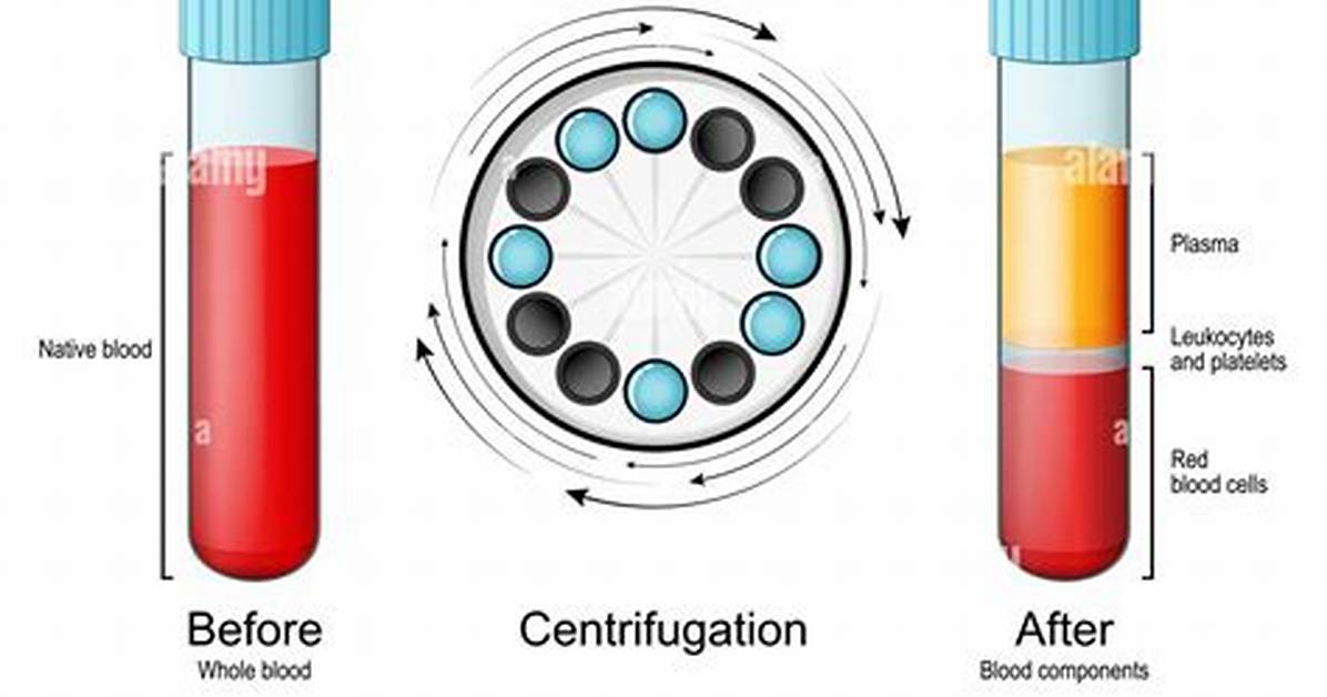 Does Centrifuging Kill Cells?