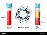 Does Centrifuging Kill Cells?