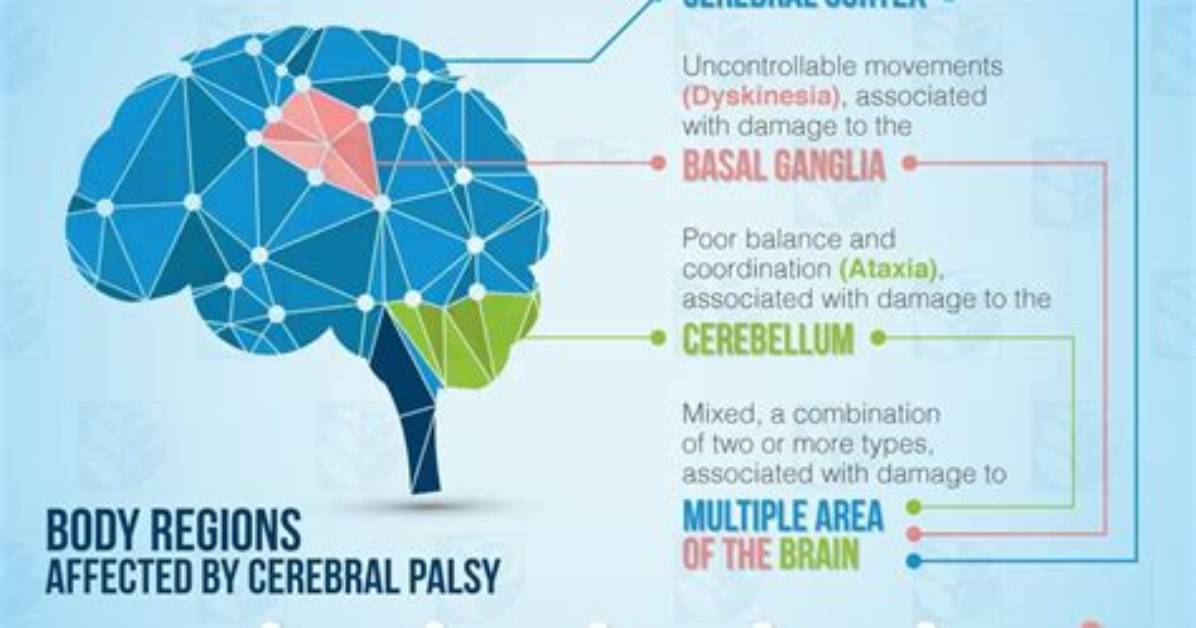 Does Cerebral Palsy Affect Intelligence?