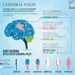 Does Cerebral Palsy Affect Intelligence?