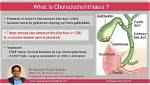 Does Choledocholithiasis Need Surgery?