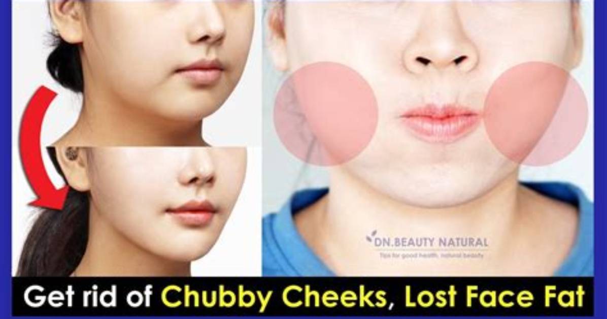 Does Chubby Cheeks Go Away?
