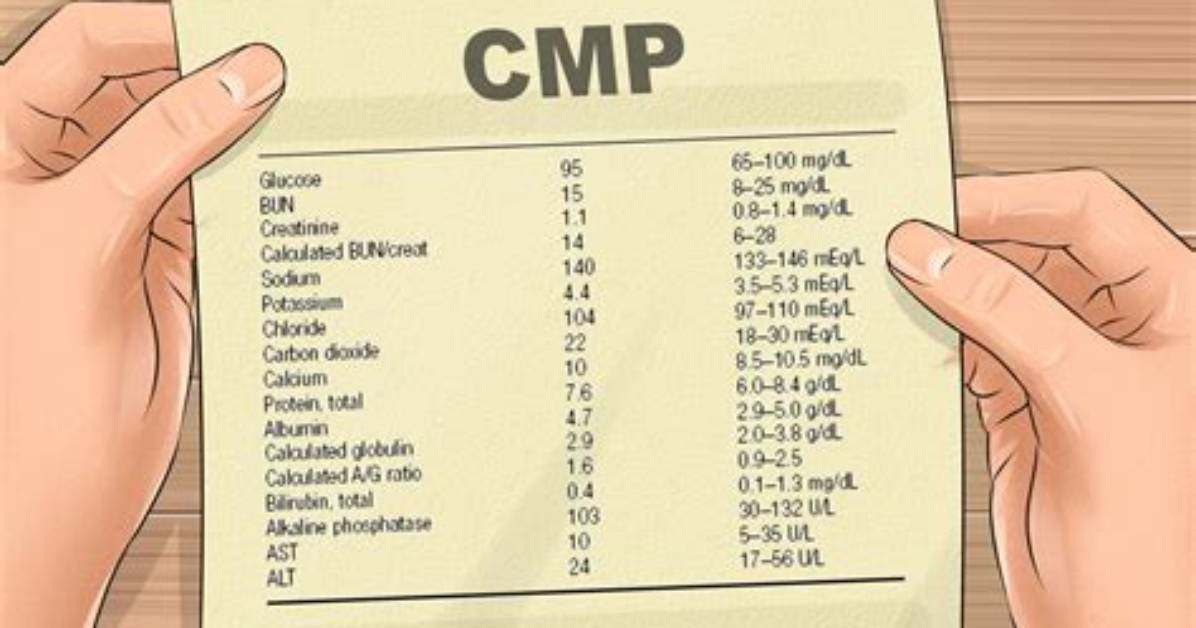 Does Cmp Have Total Bili?