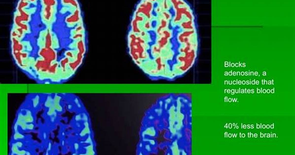 Does Coffee Affect Ct Scan?