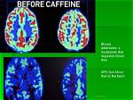 Does Coffee Affect Ct Scan?