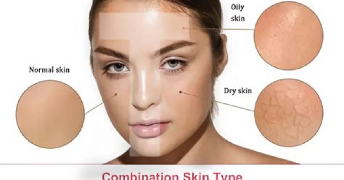 Does Combination Skin Mean?