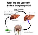 Does Constipation Cause Hepatic Encephalopathy?