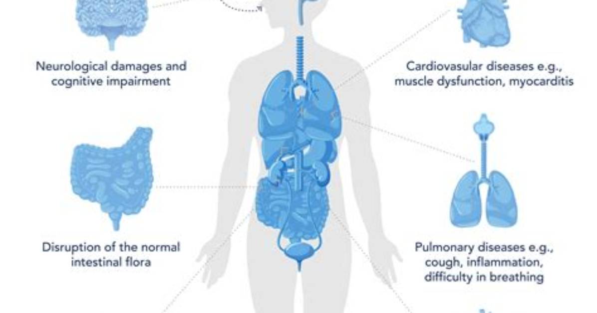 Does Covid Cause Ed?