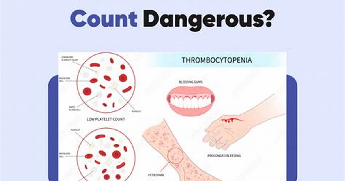 Does Cow Milk Decrease Platelet Count?