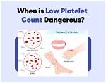Does Cow Milk Decrease Platelet Count?