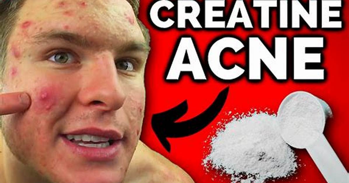Does Creatine Cause Acne