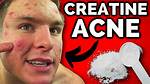 Does Creatine Cause Acne