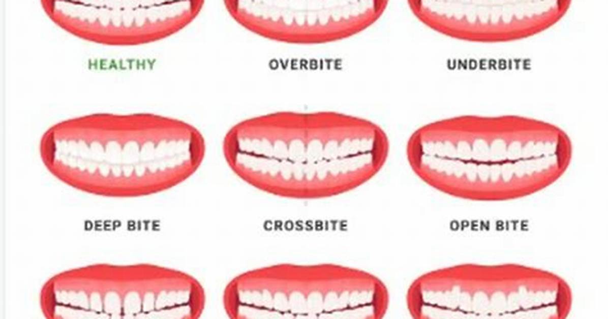 Does Crooked Teeth Affect Singing?