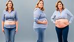 Does Cysts Cause Bloating?