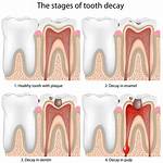Does Dentine Grow Back?