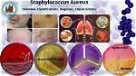 Does Dettol Kill Staphylococcus Aureus?