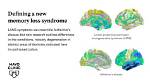 Does Dilantin Cause Memory Loss?