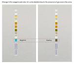 Does Disa Do Urine Test?