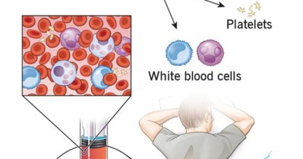 Does Donating Bone Marrow Hurt?