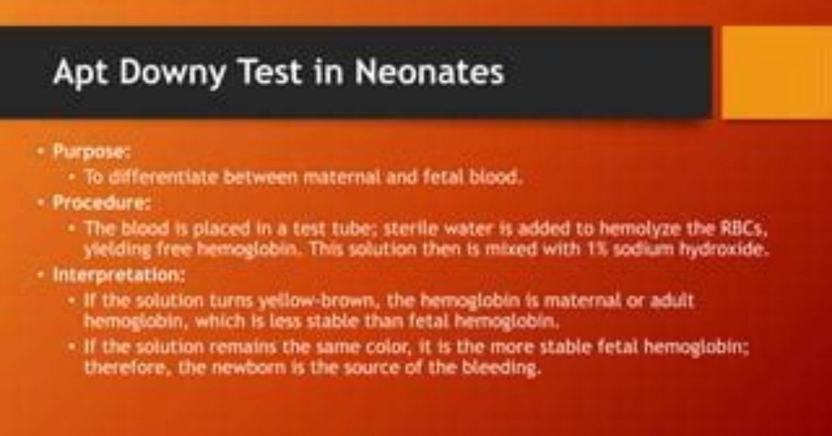 Does Downy Test on Animals?