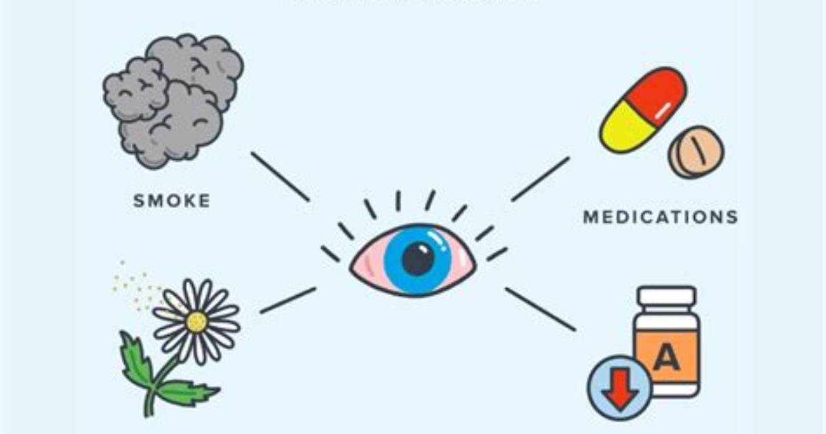 Does Dry Eye Cause Crusting?