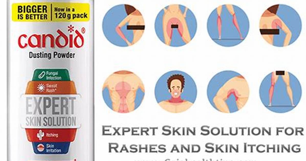 Does Dusting Powder Clear Rashes?