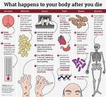 Does Dying Hurt?