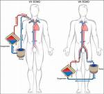 Does Ecmo Work for Covid?
