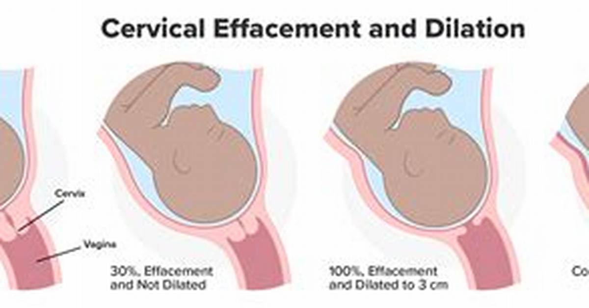 Does Effacement Predict Labor?