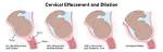 Does Effacement Predict Labor?