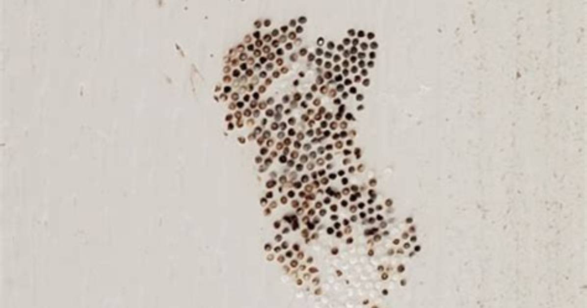 Does Egg Ruin Siding