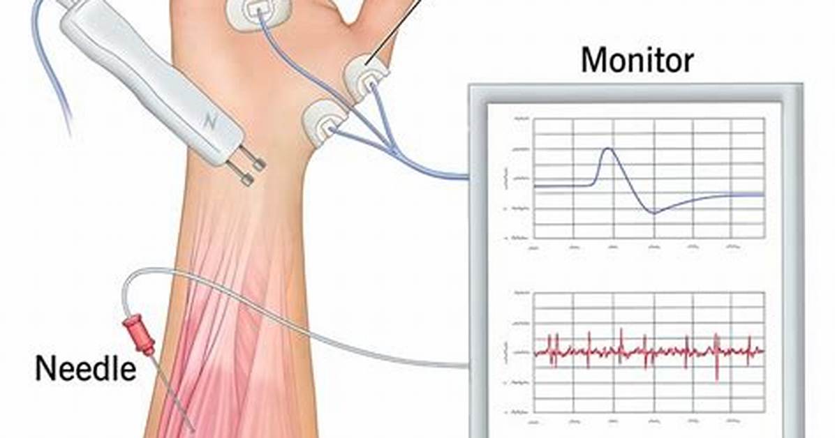 Does Electromyography Test Hurt?