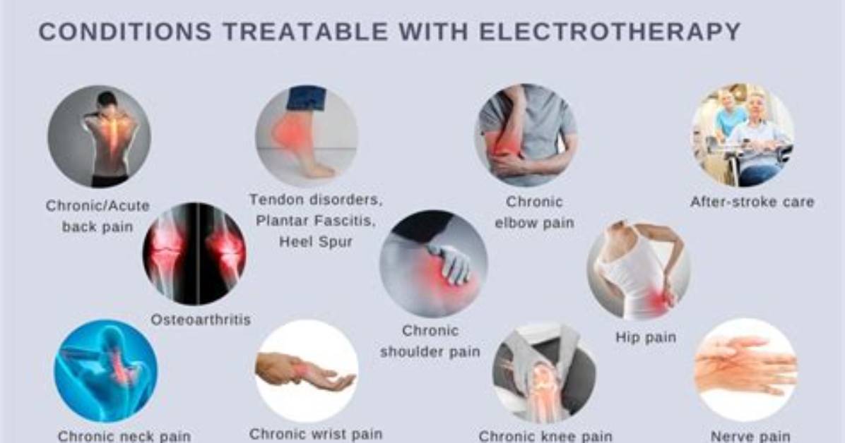 Does Electrotherapy Help Tendonitis?