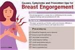 Does Engorgement Go Away?