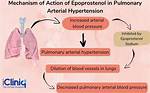 Does Epoprostenol Cause Bleeding?