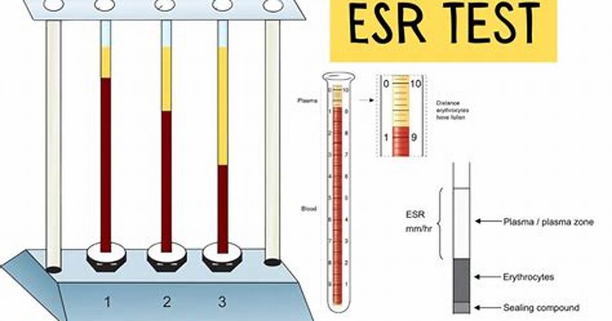 Does Esr Test Require Fasting?