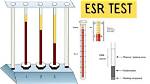 Does Esr Test Require Fasting?