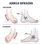 Does Eversion Cause Ankle Sprains?