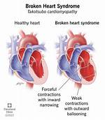 Does Everyone Get Heart Broken?