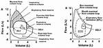 Does Exercise Affect Expiratory Flow?