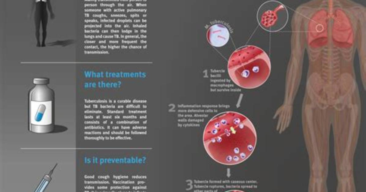 Does Extrapulmonary Tuberculosis Contagious?