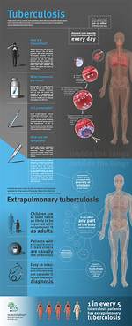 Does Extrapulmonary Tuberculosis Contagious?