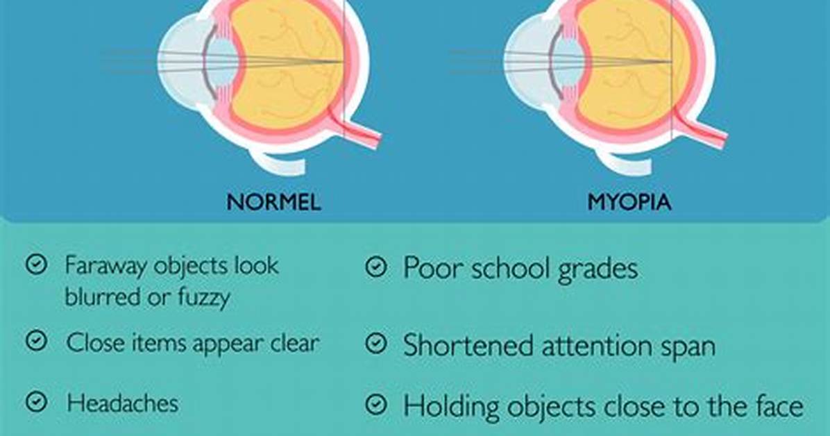 Does Eye Strain Cause Myopia?