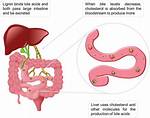 Does Fiber Bind Bile Acids