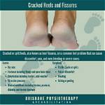 Does Fissures Come Back?