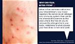 Does Flea Bites Make You Sick?